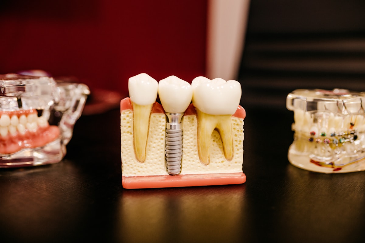 Modelo demonstrativo de implante dentário com prótese